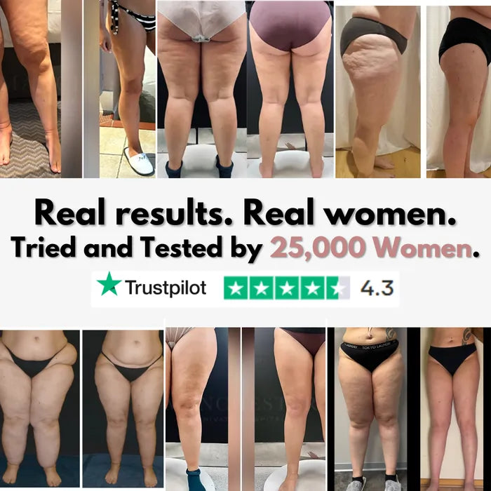 3D Legging – Say goodbye to lipoedema pain and swelling naturally