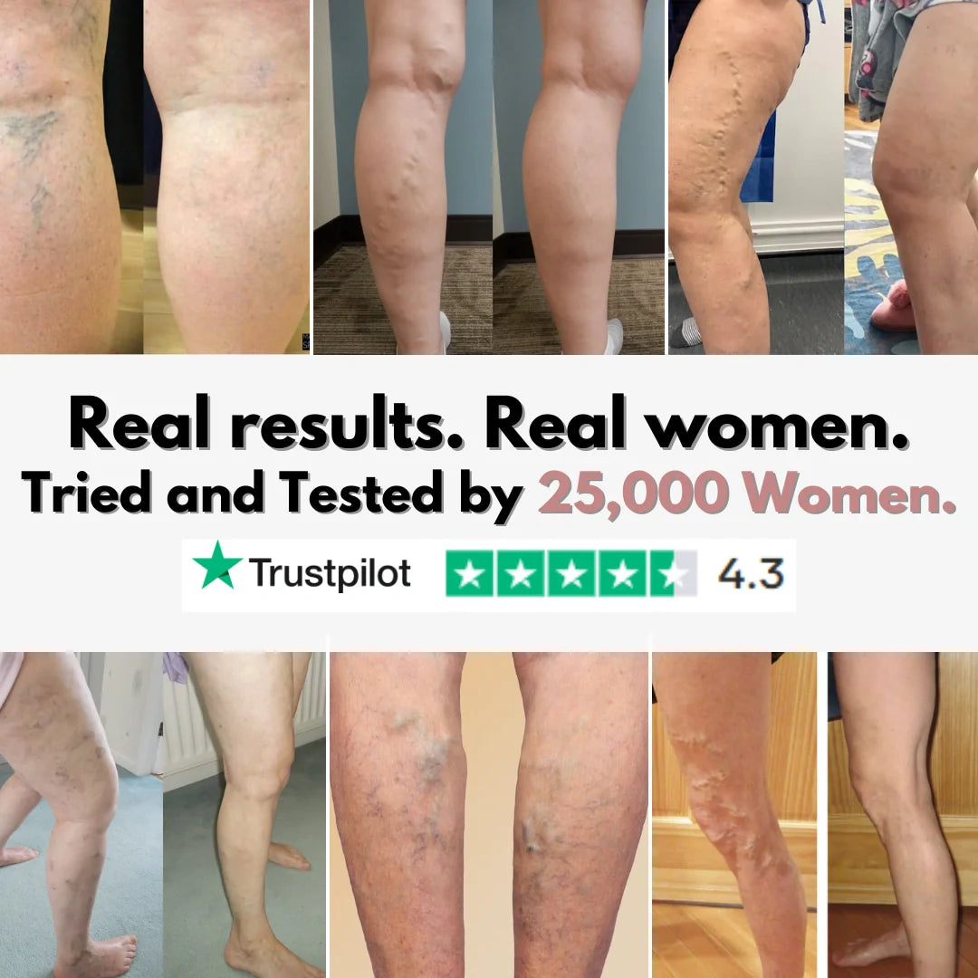 From Spider Vein & heavy legs to visible relief for healthcare workers