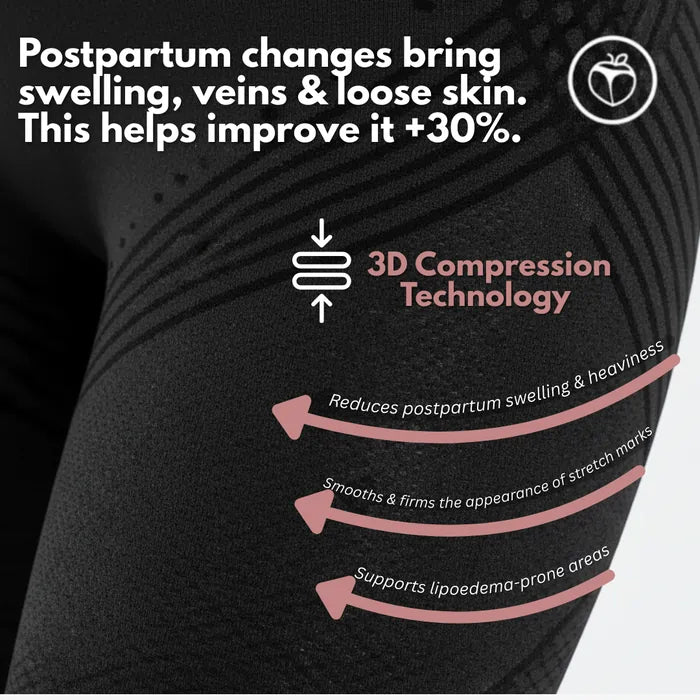 3D Legging – Post partum Edema