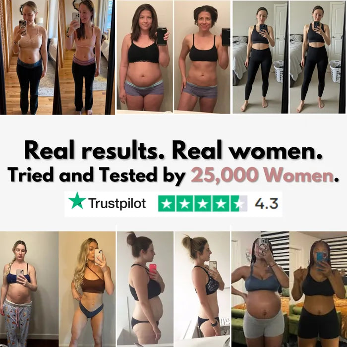 3D Legging – Post partum Edema