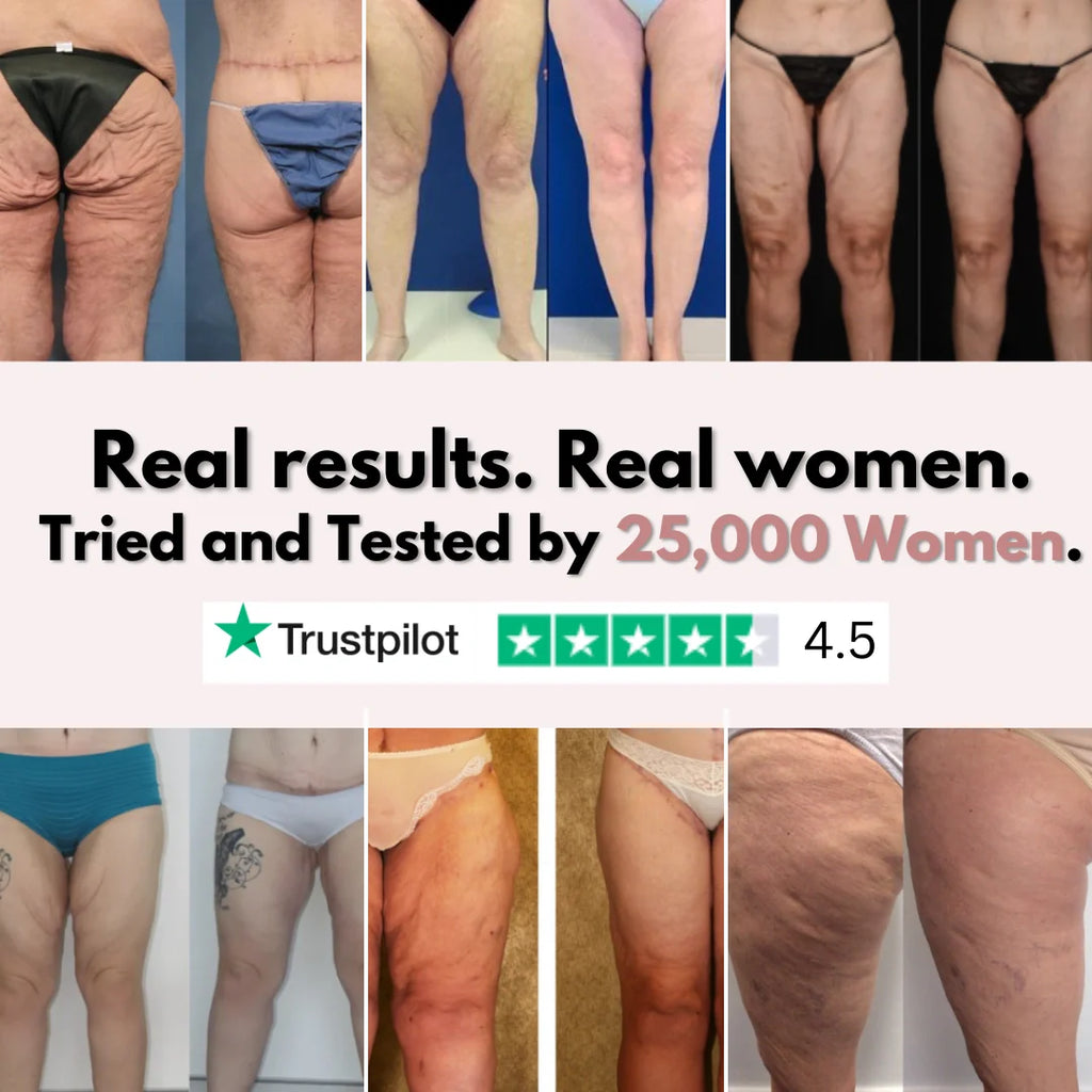 Firmer, smoother legs — for women tired of saggy skin holding them back