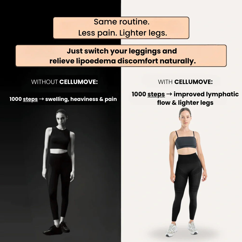 3D Legging – Say goodbye to lipoedema pain and swelling naturally