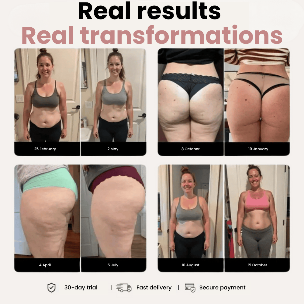 3D Legging – Say goodbye to lipoedema pain and swelling naturally