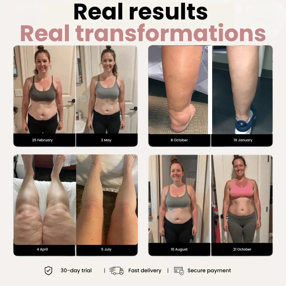 3D Legging – Designed to reduce post-partum swelling and restore comfort naturally