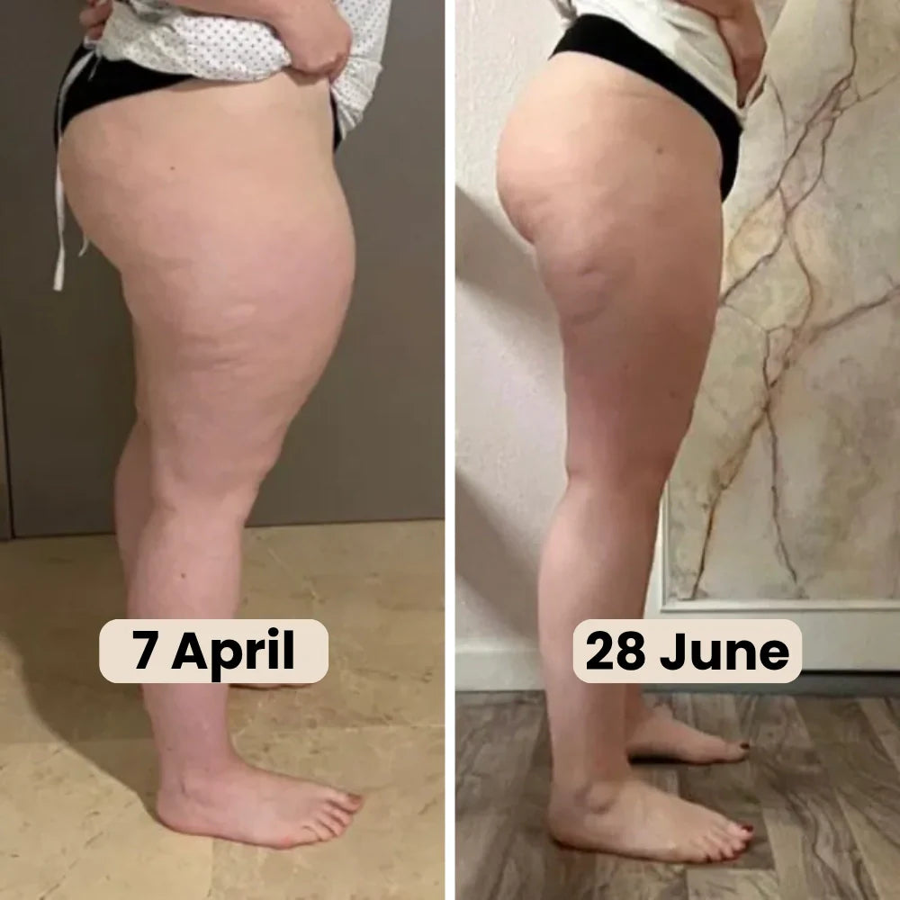 3D Legging – Designed to reduce post-partum swelling and restore comfort naturally