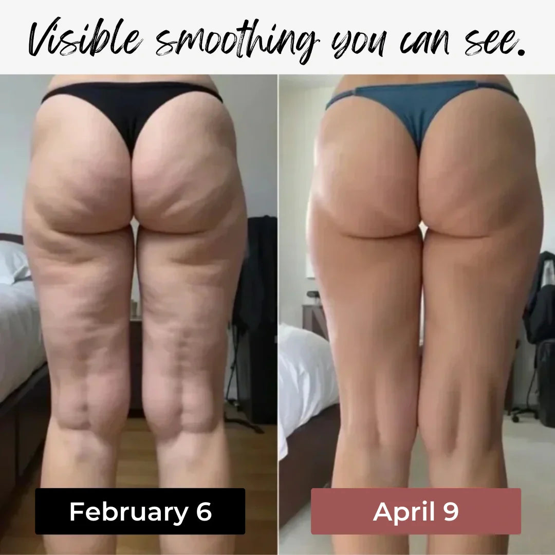 Anti-cellulite leggings designed to show visible smoothing