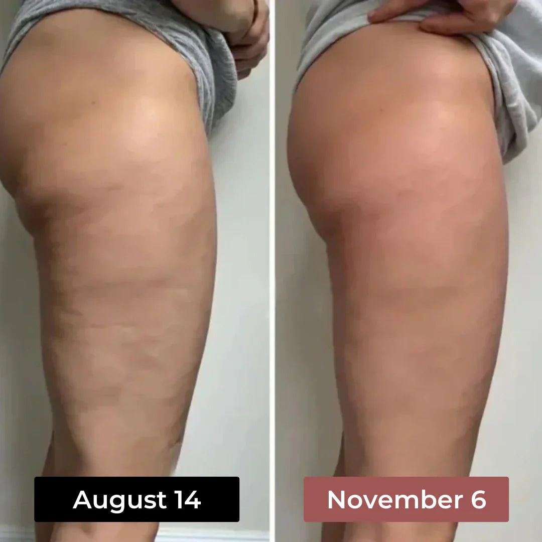 Anti-cellulite leggings designed to show visible smoothing